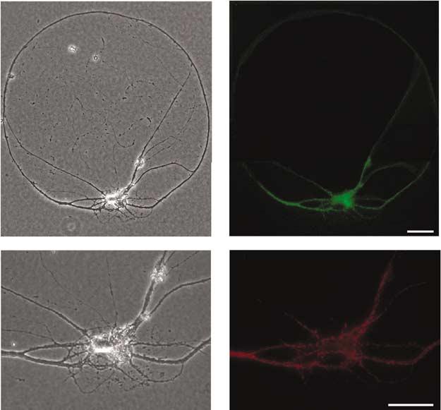 1306 a b c d Figure 3 Successful transfection of single autaptic neurons in low-density hippocampal microisland cultures. (a) Phase-contrast image of an autaptic neuron in a single microisland.
