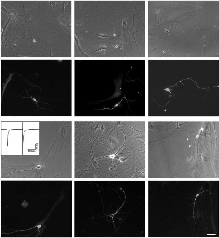1308 a1 b1 c1 a2 b2 c2 d1 e1 f1 d2 e2 f2 Figure 5 Transfection of hippocampal neurons at different ages.