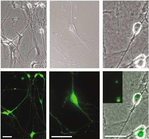 a1 b1 c1 1309 a2 b2 c2 Figure 6 Correct targeting of a variety of GFP-tagged proteins in hippocampal neurons after transfection.