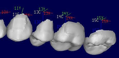 Differences in individual tooth position between SureSmile plan and post-treatment tooth position recorded in the final model were determined utilizing emodel Compare software (v8.