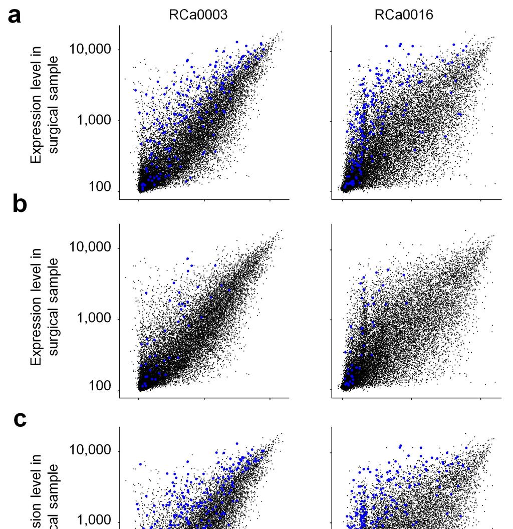 Supplementary Figure 1 SSM signature genes are highly expressed in residual scar tissues after preoperative radiotherapy of rectal