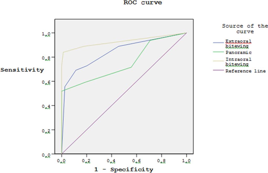 456 K Kamburoğlu et al Figure 4 Receiver operating characteristic (ROC) curves for Observer 1 for the second reading for each caries detection method with the intraoral bitewing film images.