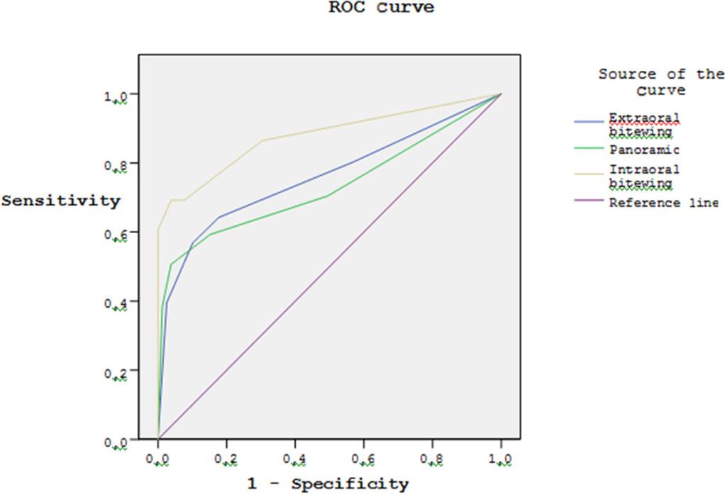 458 K Kamburoğlu et al Figure 6 Receiver operating characteristic (ROC) curves for Observer 3 for the second reading for each caries detection method significant.