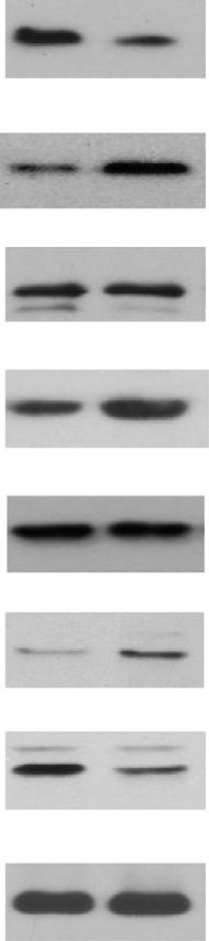 transcription with GAPDH for normalization. n ¼ 6, male for each group. (d) Increased IKK-NF-kB activities in SENP1- PATs. A representative western blot was from and SENP1- mice at the age of 7 weeks.