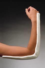 SPLINTING PRINCIPLES Long Arm Posterior Splint Extends from the axilla over the posterior elbow to the distal palmar crease Position of Function: 90 degree flexed elbow Forearm is neutral and the