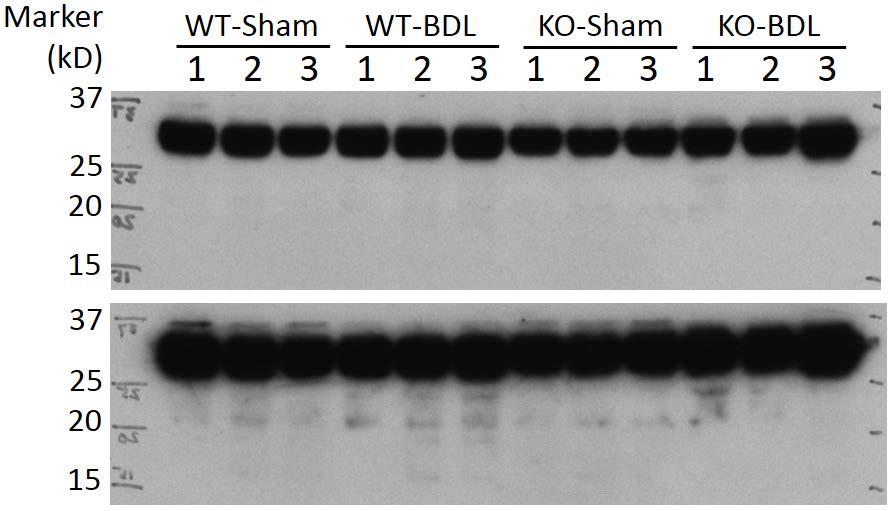 (A) reduced liver Ck19 and Ntcp protein expression in Ccl2 KO BDL mice than in WT and mice;