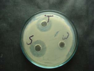 obtained against P. & S. aureus whereas least in E. coli.