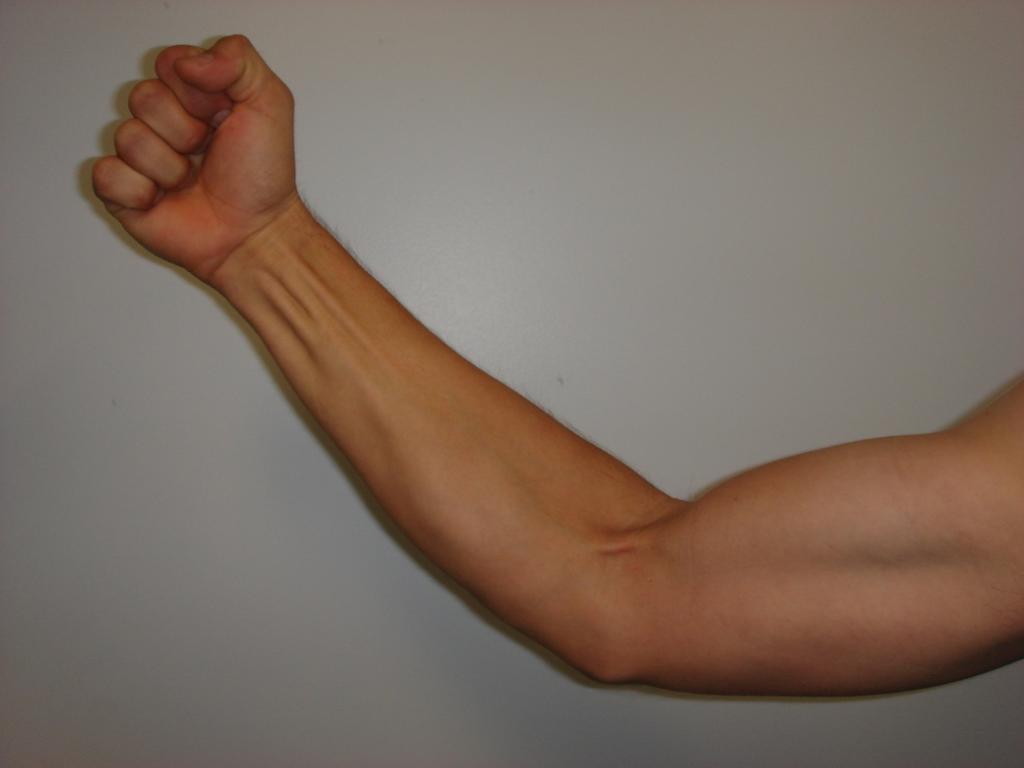 triceps Biceps brachii Anterior