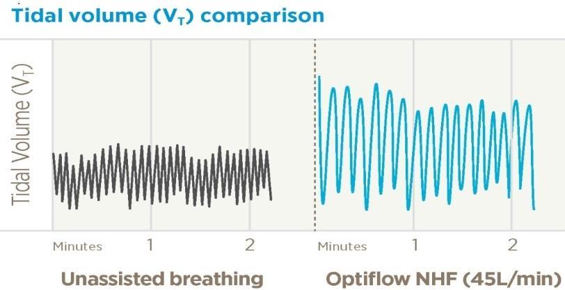 1. Respiratory Support Airway Pressure Compared to unassisted breathing, tidal volume