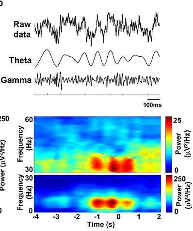 Time-frequency analysis EEG to