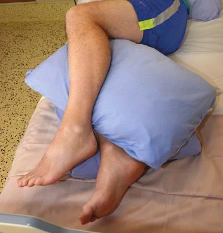Here is another example of floating the feet off the bed using pillows. Waffle boots are an example of a device. Floating feet off bed. What are the risk factors?