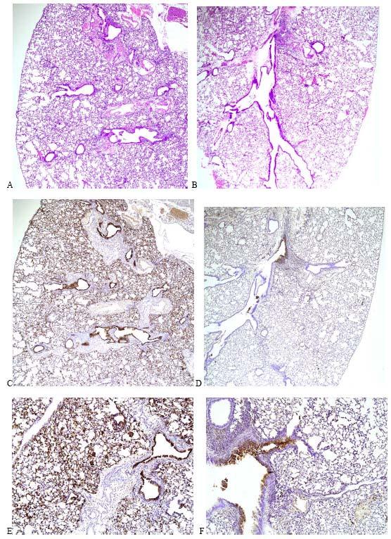 Histopathology in mice challenged with H5N1 virus following immunoprophylaxis