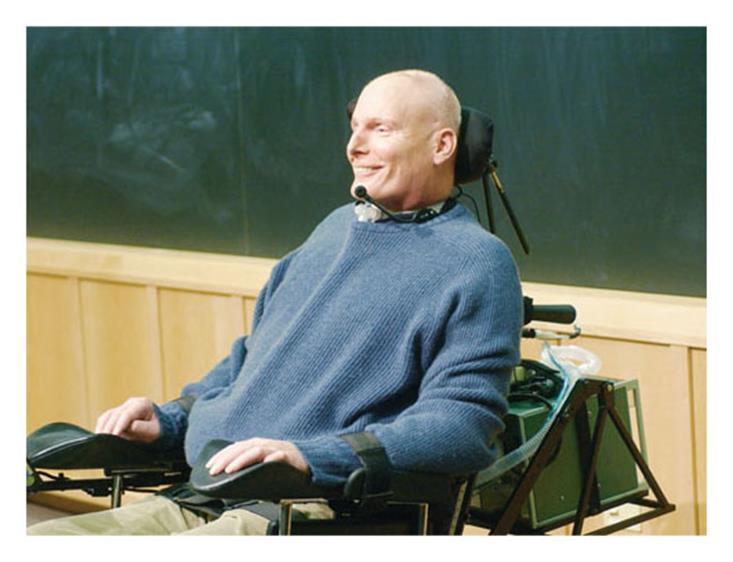 CHRISTOPHER REEVE The late actor Christopher Reeve Suffered a spinal