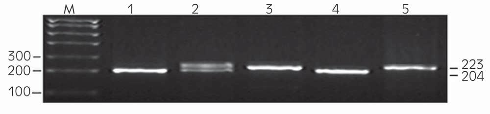 J Med Biochem 2015; 34 (4) 395 Figure 1 Agarose gel electrophoresis (3%) of PCR amplification product of LAPTM4B gene polymorphism.