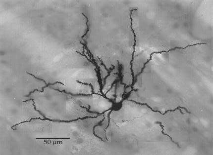 Striatum Medium Spiny Neurons I MSNs = Medium Spiny Neurons > 90% of all cells in striatum >10,000 cortical inputs to one MSN GABAergic