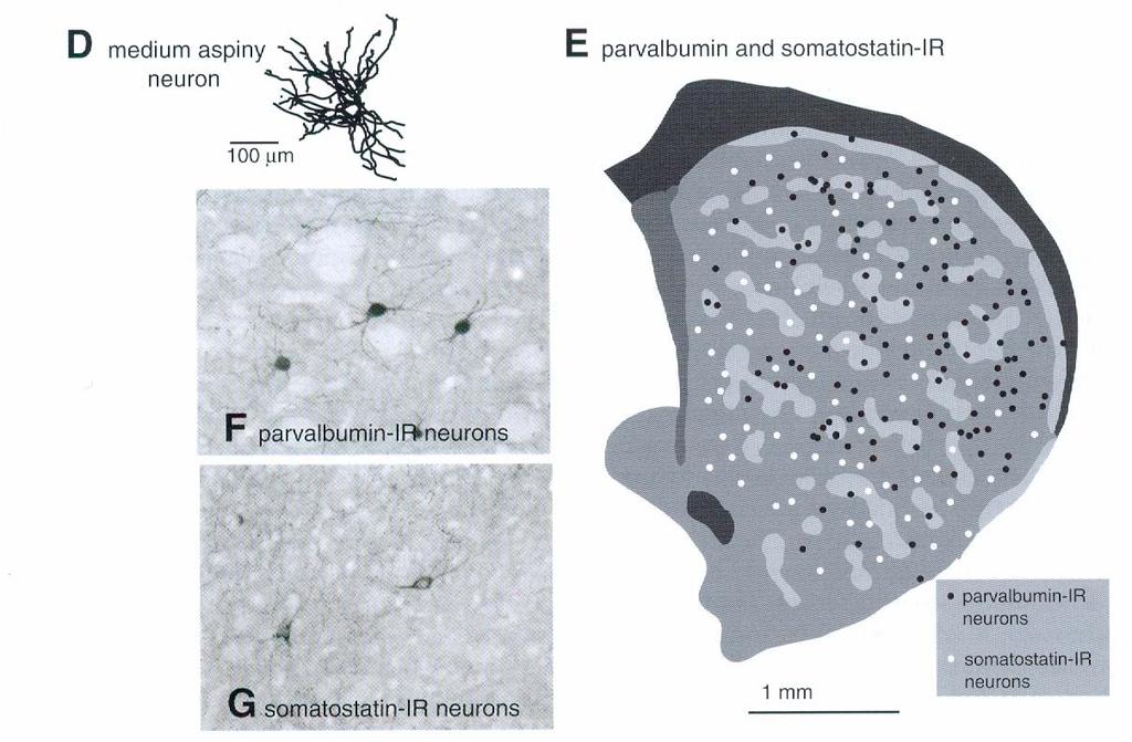 The GABAergic interneurons of the striatum FSNs: medium aspiny neurons