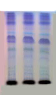 developing, the plates were dried and observed the colour spots at UV-254, UV-366 nm and vanillin-sulphuric acid spraying reagent (Wagner et. al., 1984).