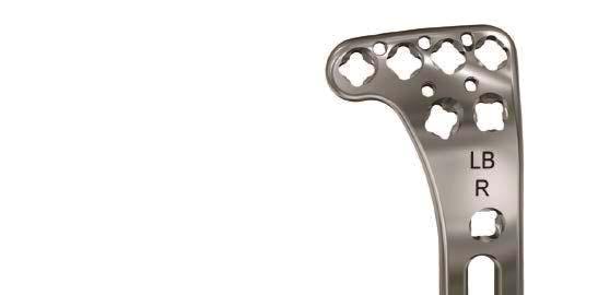 5 mm VA-LCP Proximal Tibia Plate System has many similarities to standard locking fixation methods, with a few important improvements.