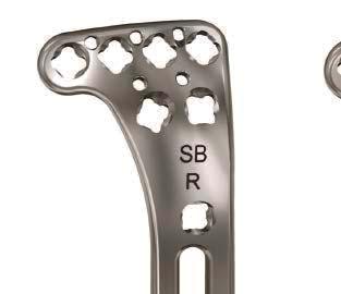 A fixed-angle construct provides advantages in osteopenic bone or multifragmentary bridge-plated fractures where screws do not rely on plate-tobone compression to resist patient load. The 3.