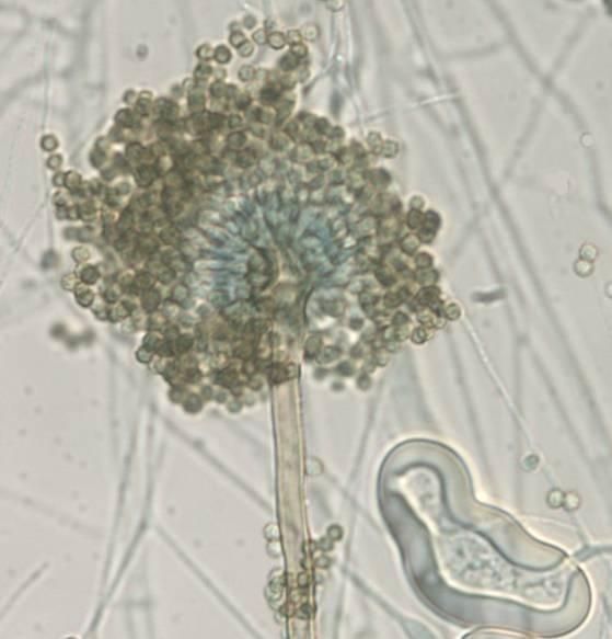 Aspergillus spp. Isolates Submitted to San Antonio Fungus Testing Laboratory 918 Isolates; Jan. 2001-July 2004 A. flavus 12% A. niger 10% A. terreus 12% A. nidulans 3% A. ustus 2% A.