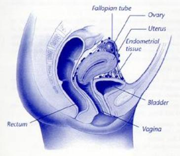 Palm Beach Obstetrics & Gynecology, PA 4671 S. Congress Avenue, Lake Worth, FL 33461 561.434.0111 4631 N.