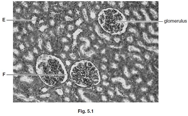 Question: 5 Fig. 5.1 is a photomicrograph of a horizontal section through the cortex of a mammalian kidney.