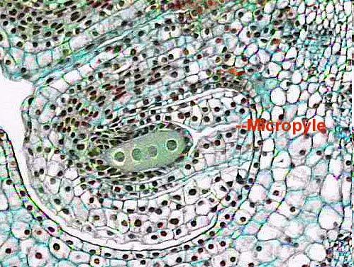 Four Megaspores x100 within the old megaspore mother cell. The slit-like micropyle is to the right of the megaspores.