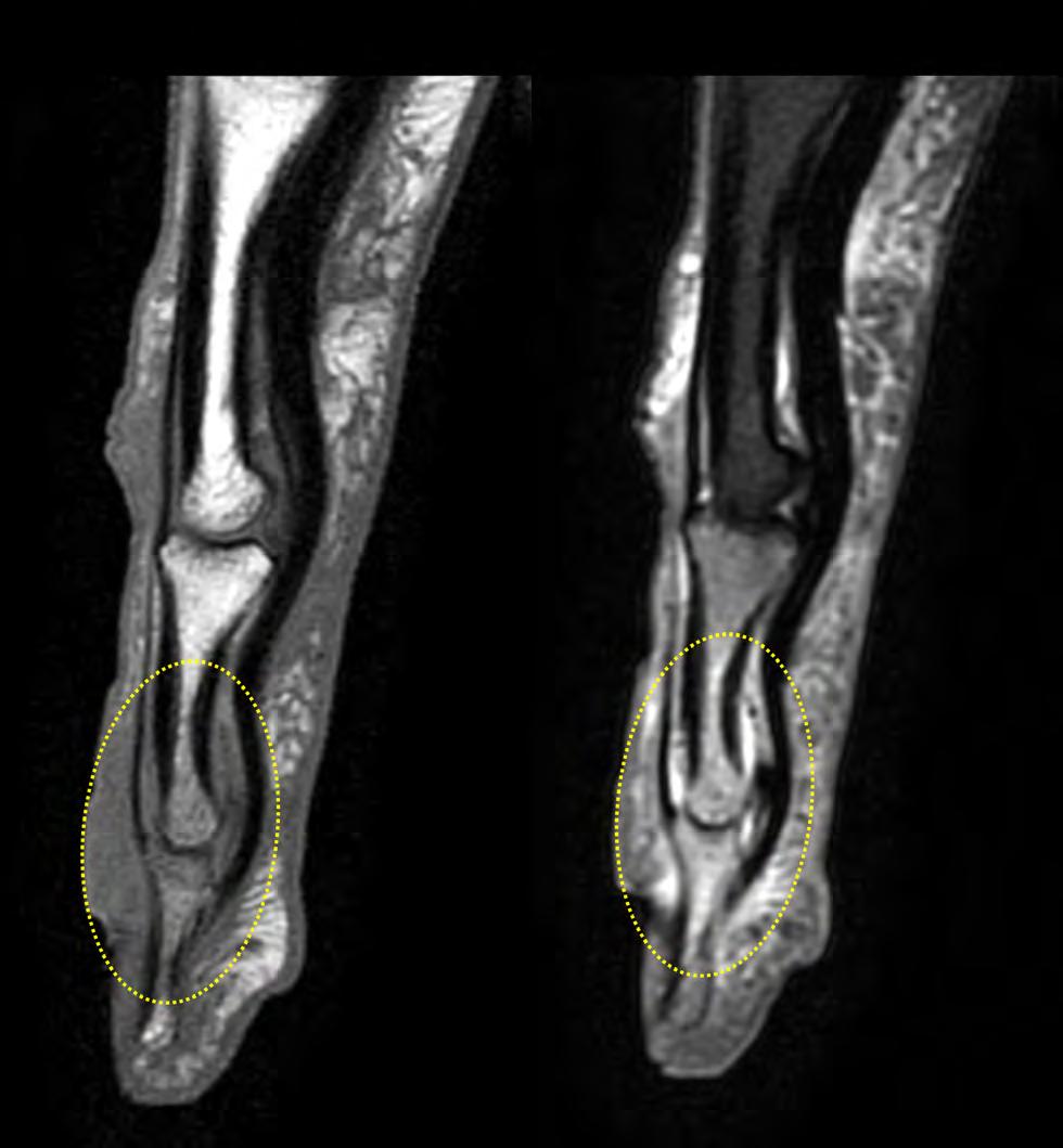 MRI of the finger MRI of the finger with high SNR and good resolution in a 10 cm field of view
