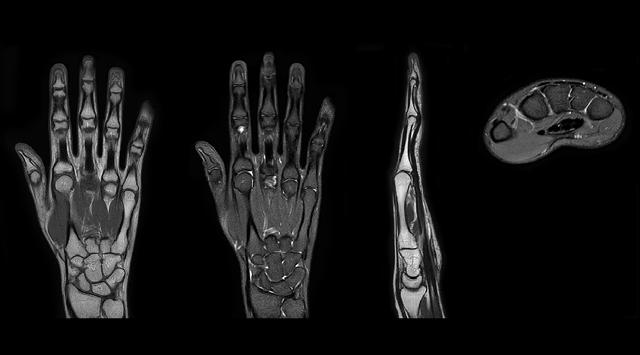 Clinical cases from Radiology Schiffer MRI of