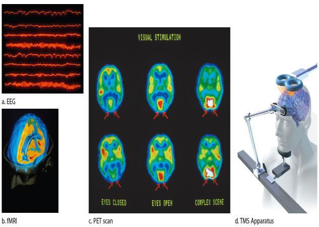 A. Monitoring Neural Activity Magnetic Resonance Imaging (MRI) Uses magnetic fields to trace activity & make up of tissue Images are clearer and more detailed than CT scans Positron Emission