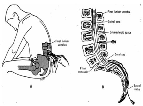 II. SECTIONAL ANATOMY OF THE SPINAL CORD A. GRAY MATTER VS.