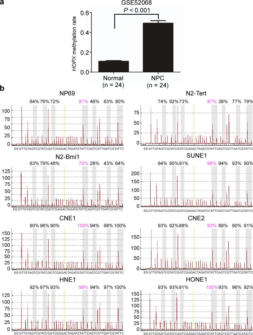 Supplementary Figure 1. HOPX is hypermethylated in NPC. (a) Methylation levels of HOPX in Normal (n = 24) and NPC (n = 24) tissues from the genome-wide methylation microarray data. Mean ± s.d.; Student s t-tests.