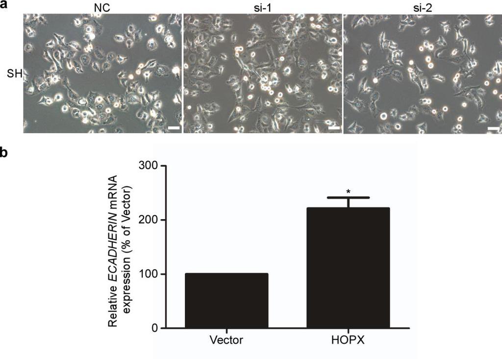 Supplementary Figure 6. HOPX partially inhibits EMT in NPC cells. (a) Phase contrast images (200 ) of SH cells which were transfected with the control NC or HOPX-siRNAs (si-1 and si-2).