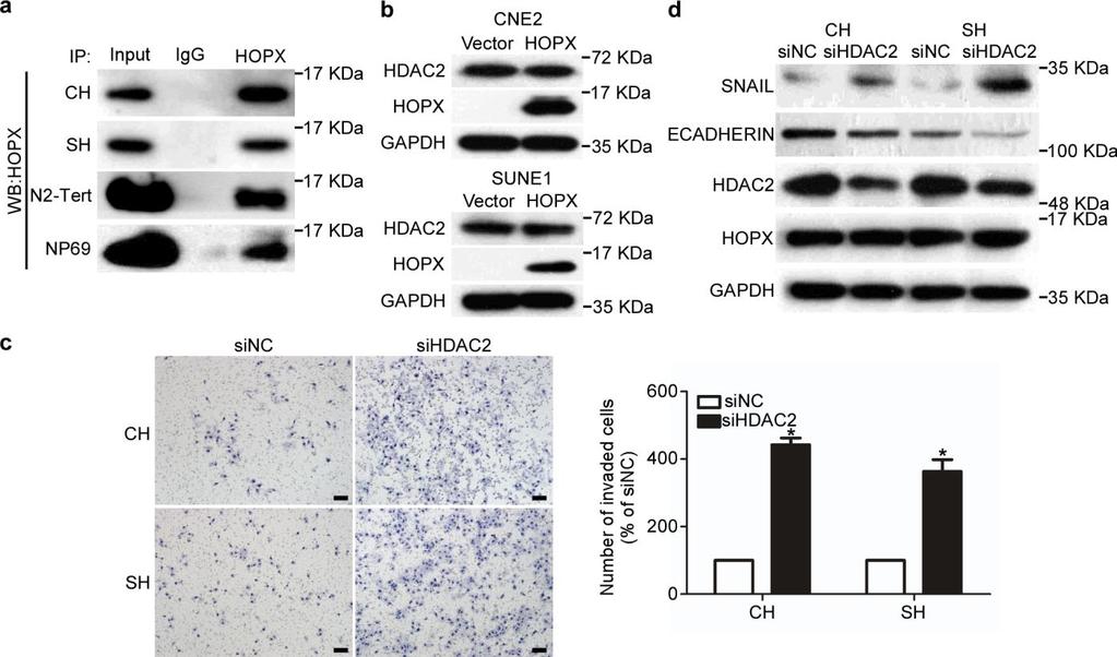 Supplementary Figure 8. Silencing HDAC2 reverses the inhibitory effects of HOPX on invasiveness and EMT in NPC. (a) IP assay using anti-hopx antibody was performed to pull down HOPX.