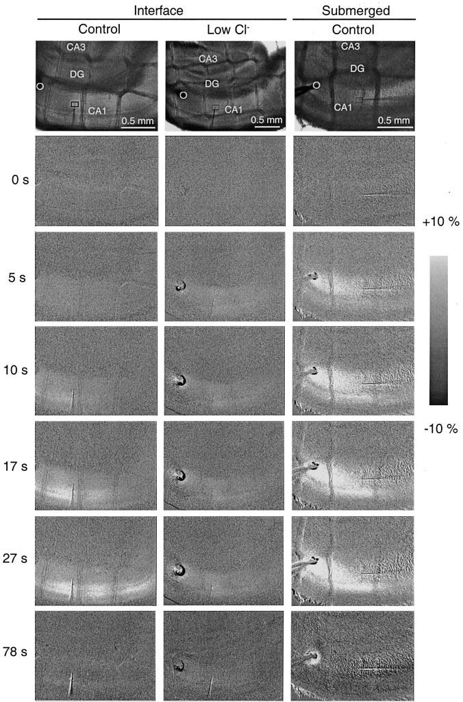 INTRINSIC OPTICAL SIGNALS IN BRAIN SLICES 1927 FIG. 1. Images of intrinsic optical signals (IOSs) during and after synaptic activation.