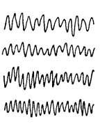 Basic EEG Rhythm Identification Rhythm > Frequency Component Alpha 8.