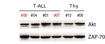 Figure S1. Akt levels are similar in primary T-ALL samples with or without activation of PI3K/Akt signaling pathway and in normal thymocytes.