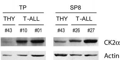 Figure S7. Isolated normal T-cell precursor subpopulations express lower CK2 protein levels than their malignant immunophenotypical equivalents.