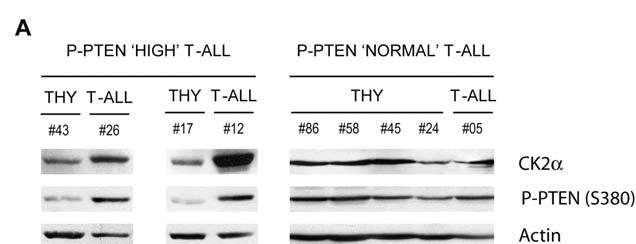 Figure S9. PTEN phosphorylation correlates with CK2 expression in PTENpositive primary T-ALL cells.