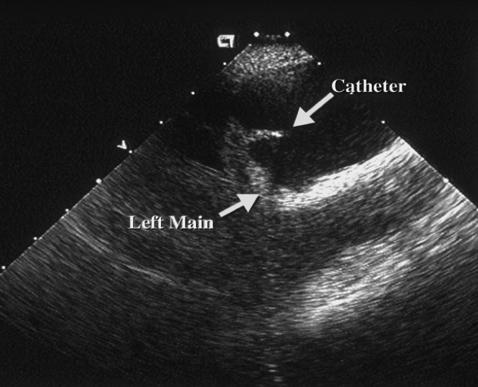 ultrasound showing