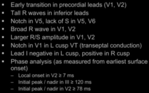 Aortic Cusp VT ECG Criteria Early transition in precordial leads (V1, V2) Tall R