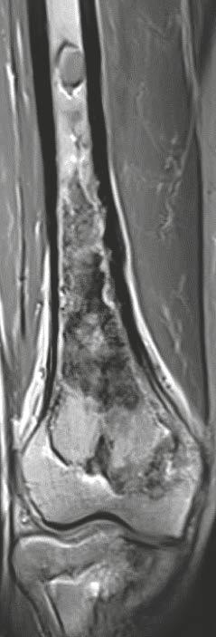 the knee, (12C) coronal contrast-enhanced T1w MRI,