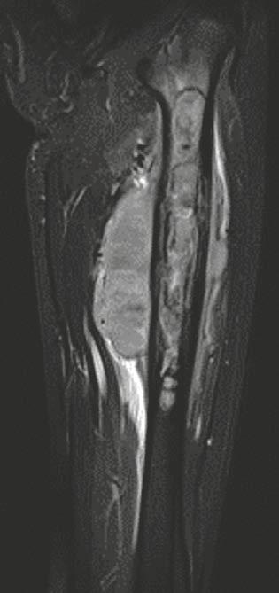 Clinical Orthopedic Imaging Summary Role of X-ray In addition to patient history and clinical findings, a radiograph in two orthogonal planes is still of great importance for determining the Lodwick