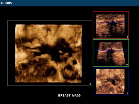 There is often doubt with 2D imaging when you are scanning in fixed planes and concern that something may have been missed. Viewing ultrasound images is not the same as CT and MR.