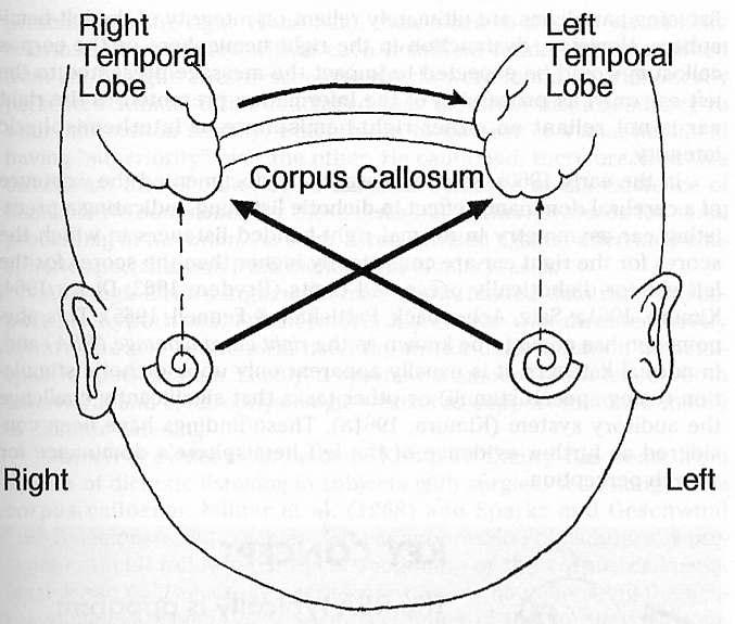 Dichotic Listening Kimura (1961): contralateral pathways are stronger & more numerous than ipsilateral During dichotic listening the
