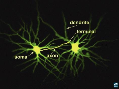 Indicate that these pathways are made up of neurons. This image contains real neurons from the thalamus. They have been filled with a fluorescent dye and viewed through a microscope.