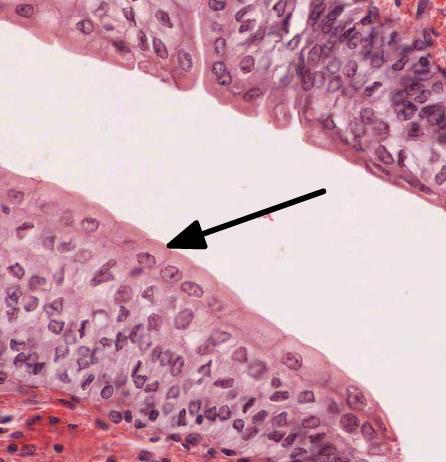 Concept Check The type of epithelium indicated by the arrow lines the: a) skin b)