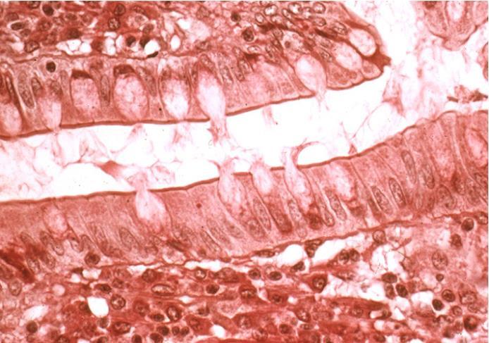 type of epithelium shown in this image is: a) Simple cuboidal b) Simple columnar