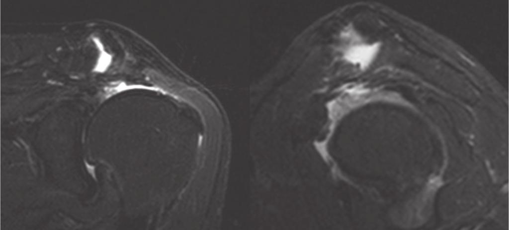 Bilateral Shoulder Pain, p. 64-69 HR J Fig. 1.