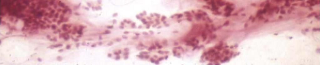 Clusters of cells are embedded within the mucus.